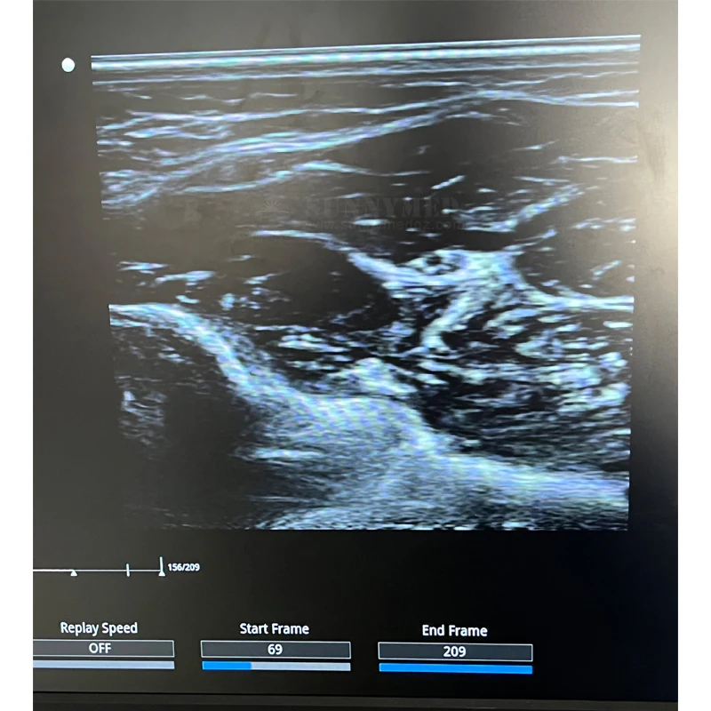 SYA-D40 نظام عربة الموجات فوق الصوتية شاشة لمس ثلاثية الأبعاد/4D