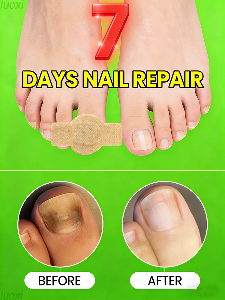 爪板の輝きと滑らかさを回復し、新しい成長を促進します。日常の問題を解決する迅速な除去方法です。