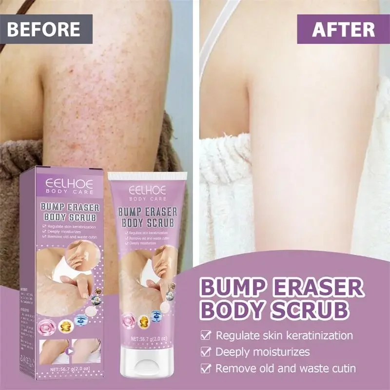 7-Day Fast Body Scrub Cream Moisturizing Skin Repair Keratosis Pilaris Removing Strawberry Legs Eraser Nourishing Body Skin Care