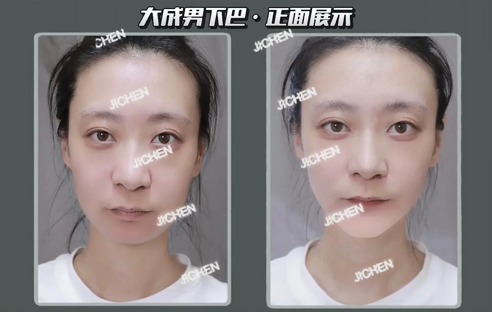 Jct Silicona Falsa … - image