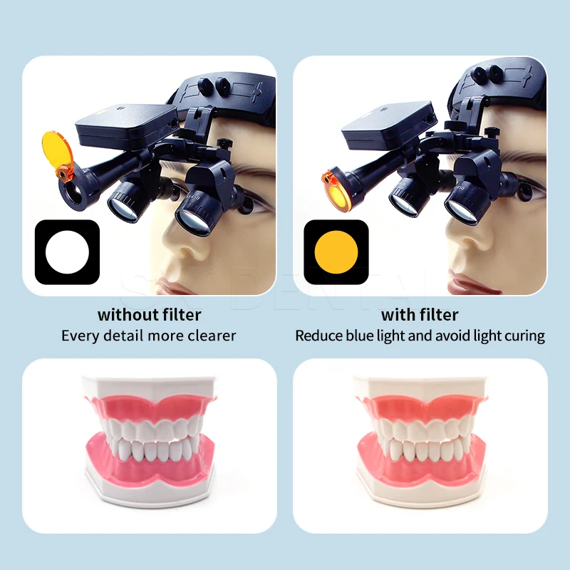 4X 5X 6X Dental Loupes with 5W LED Magnetic Headlight 48°Angle Surgical Binocular Loupes for ENT Stomatology Clinical Surgeon