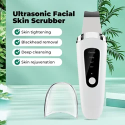 Ultrasonic Skin Scrubber Deep Vibrating Cleansing Spatula Ultrasonic Ionic Pore Cleanser Blackhead Remover Shovel Skin Care Tool