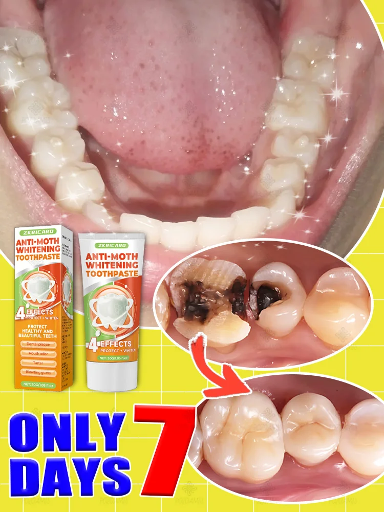 Rᴇᴘᴀɪʀ ᴛᴏᴏᴛʜ ᴅᴇᴄᴀʏ, ᴛᴏᴏᴛʜ ᴅᴇᴄᴀʏ, ʀᴇʟɪᴇᴠᴇ ɢᴜᴍ ᴘᴀɪɴ, ᴛᴇᴇᴛʜ ᴡʜɪᴛᴇɴɪɴɢ