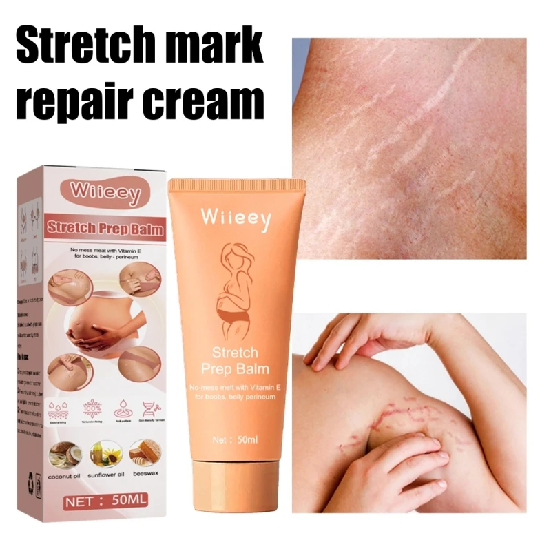 Stretch Marks Removal Mark Cream Postpartum Obesity For Pregnant Women Child Anti-Aging Anti-Winkles Firming Body Repai