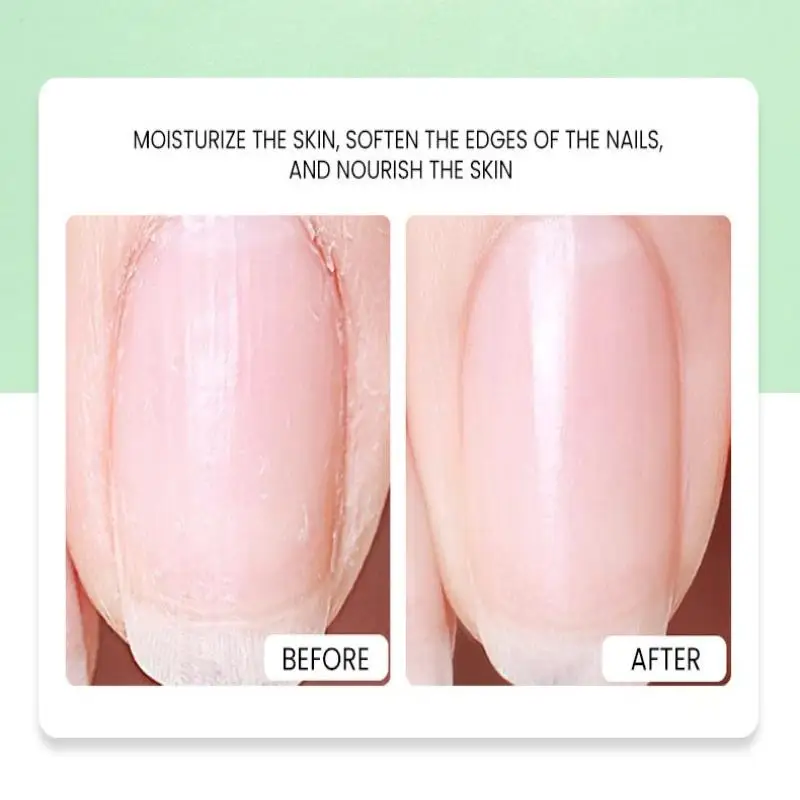 Aloe Cuticle Oil Pen Nail Nutrition Oil Nail Treatment Prevent Hangnail Nail Edge Care Beauty Health Finger Care Tool
