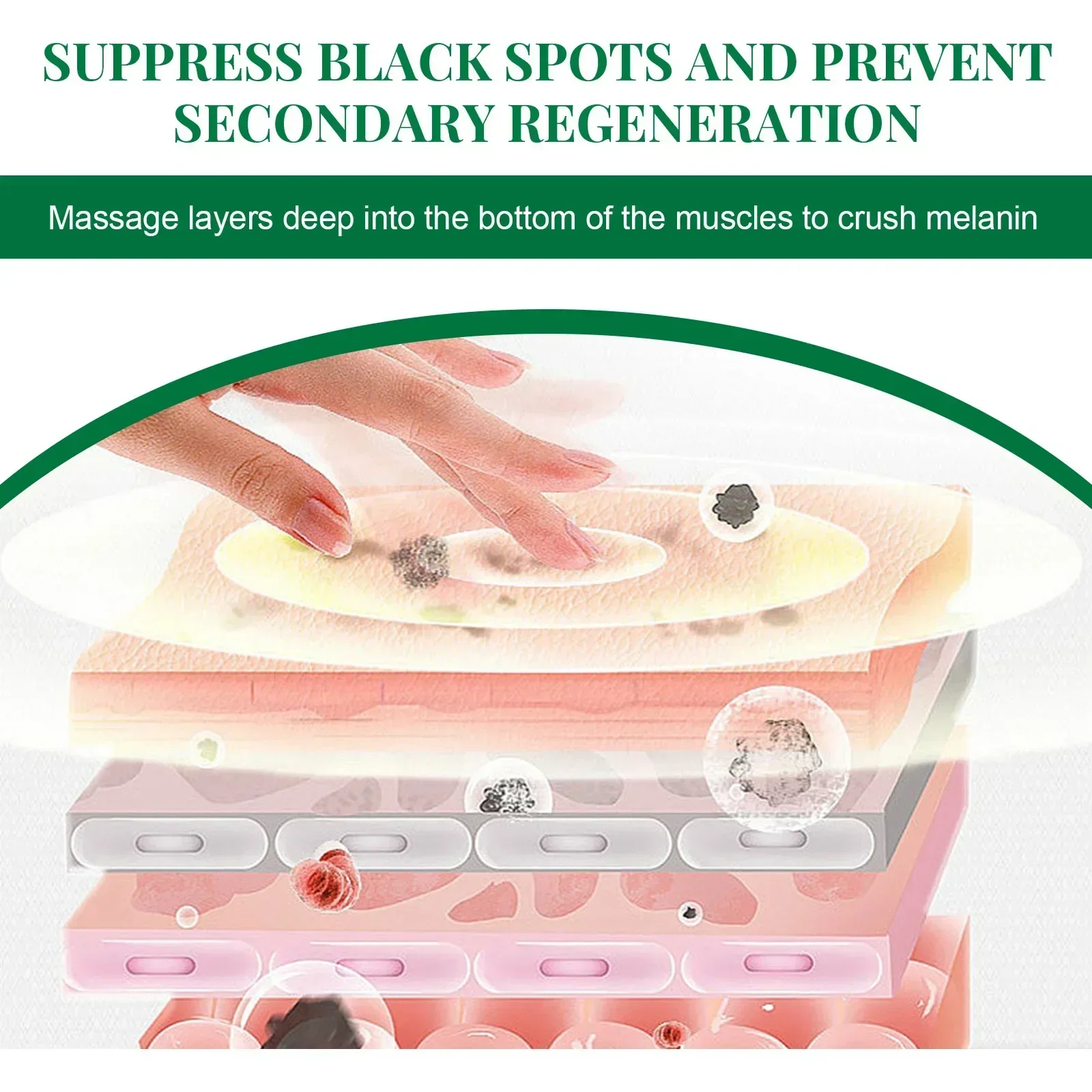 كريم تفتيح الكلف نياسيناميد ، تقليل كريم تفتيح الميلانين ، تفتيح البشرة الداكنة ، سيروم الكلف ، تلاشي خطوط الوجه الدقيقة #5