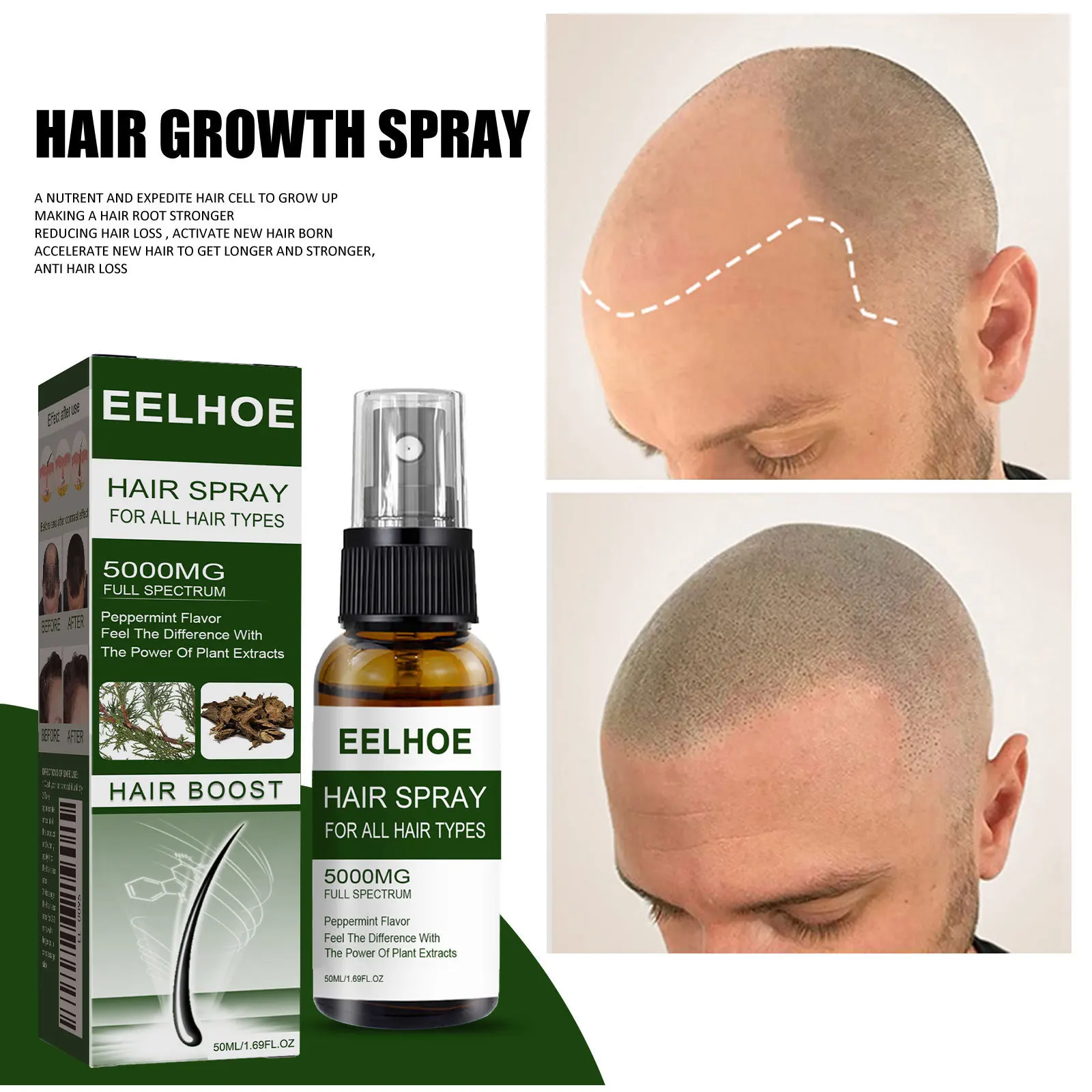 Anti Drop Hair Care Spray Hair Thick, Strong and Beautiful Hair Anti Drop Hair Firming Hair Moisturizing Hair