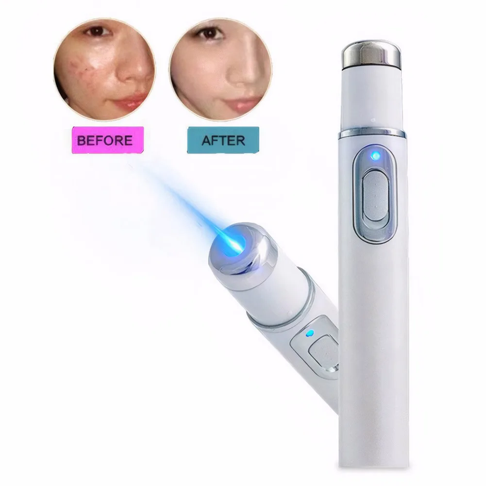 Blauwlichttherapie Acne Pen Oogschoonheidsapparaat Oogmassage-instrument voor donkere kringen Oogzakken Wallen onder de ogen