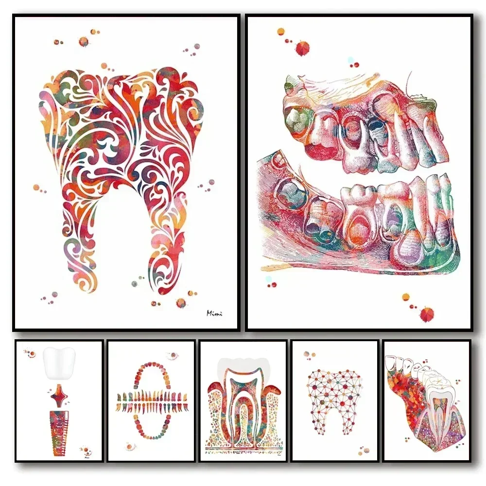 Abstract Dental Art Tooth Implant Prints Mouth Anatomy Illustration Poster Canvas Painting Wall Pictures Home Clinic Decor