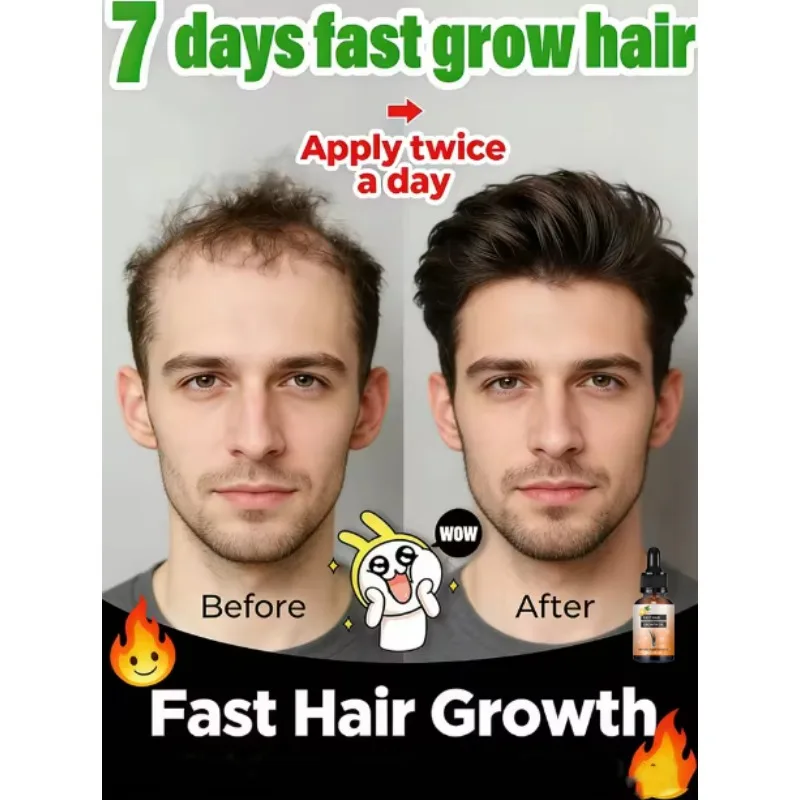 

99% Repurchase, More and More Hair, Say Goodbye to Baldness, Hot Selling Product