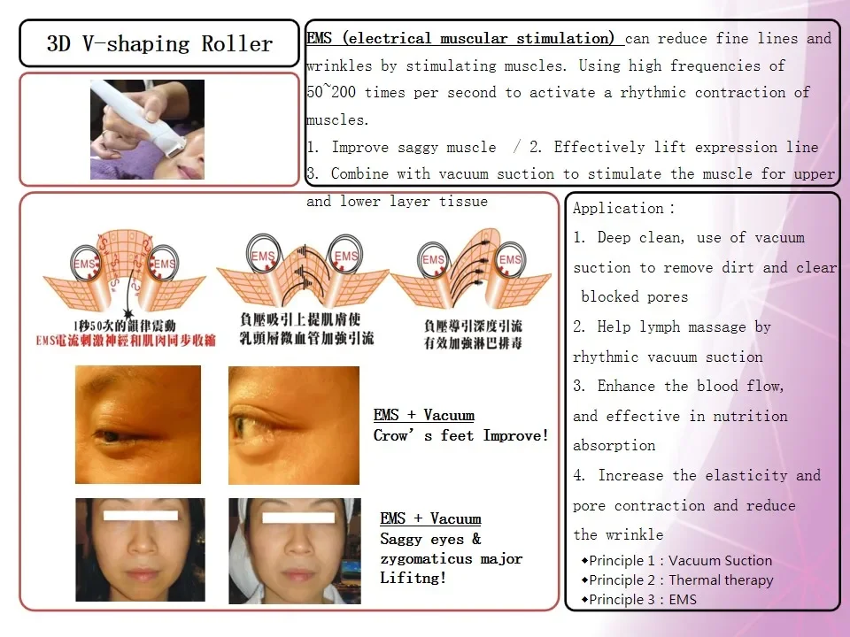 Masajeador facial de microcorriente EMS, máquina antiarrugas con vibración, Bola de rodillo para estirar la piel, novedad de 2024