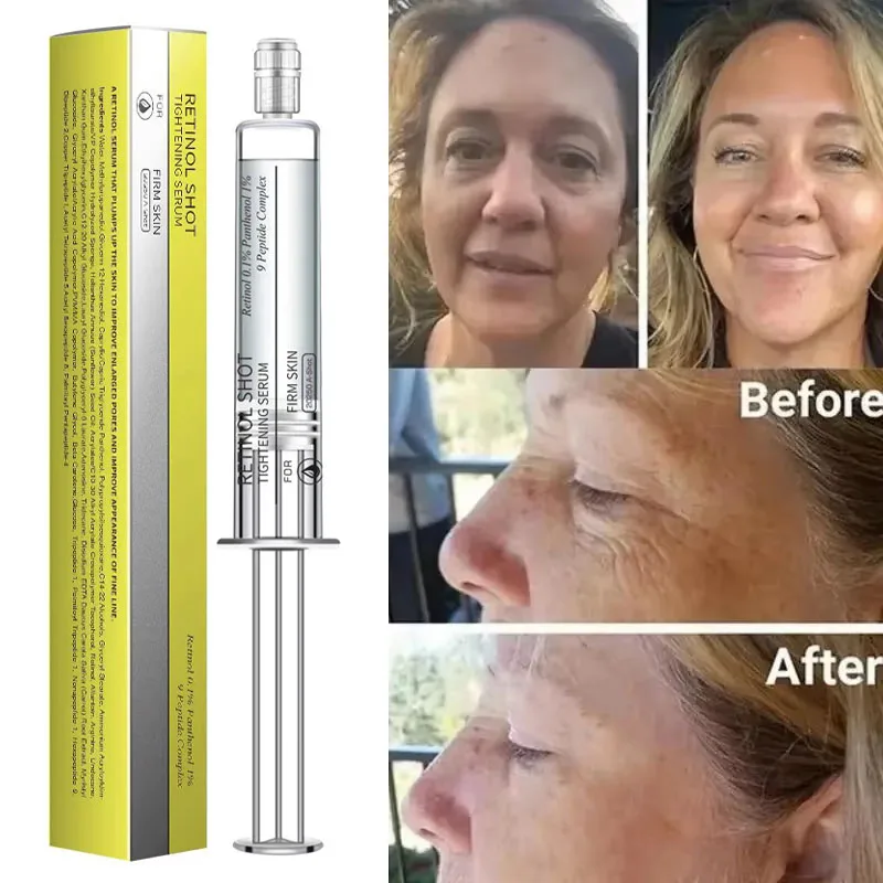 مصل الوجه لإزالة التجاعيد الفورية من الريتينول لشد البشرة والخطوط الدقيقة الكورية المضادة للتجاعيد منتجات العناية بالبشرة ﻿