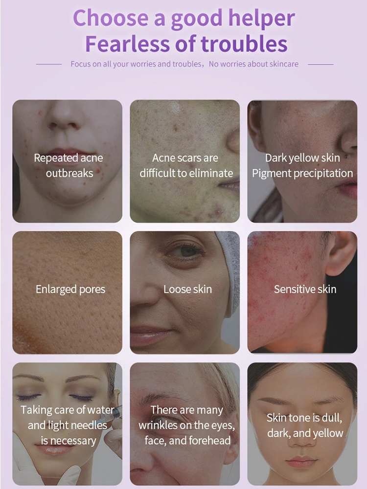 HIFU Gesichtsradiofrequenz Schönheitsbehandlung Hautverjüngung Lifting Straffung Schönheitsinstrument