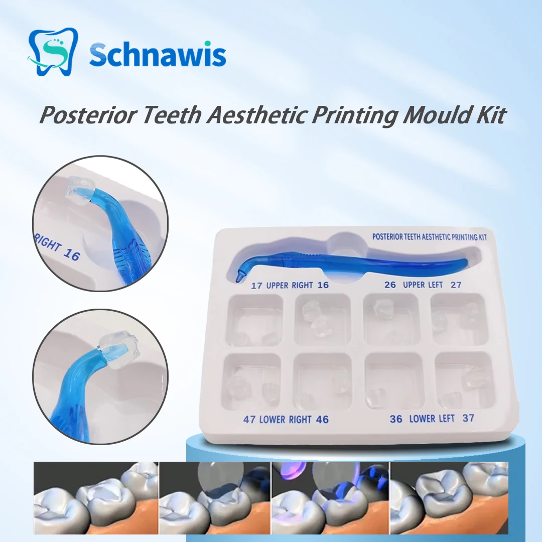 Dental Posterior Teeth Aesthetic Printing Mould Kit For Light Cure Composite Restoration Filling Tools