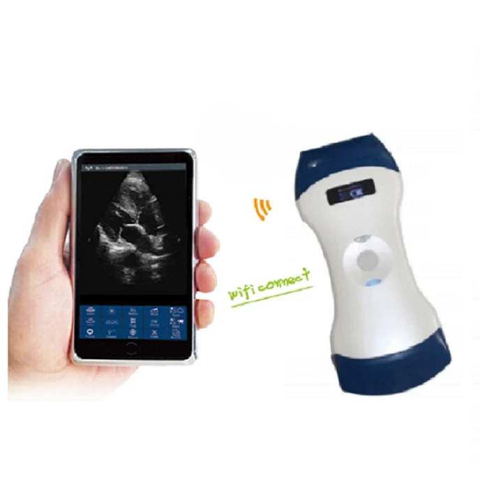 

Original brand newMT MED·ICAL 3 IN 1 color dop·pler 128 elements wireless ultrasound portable scanner machine price