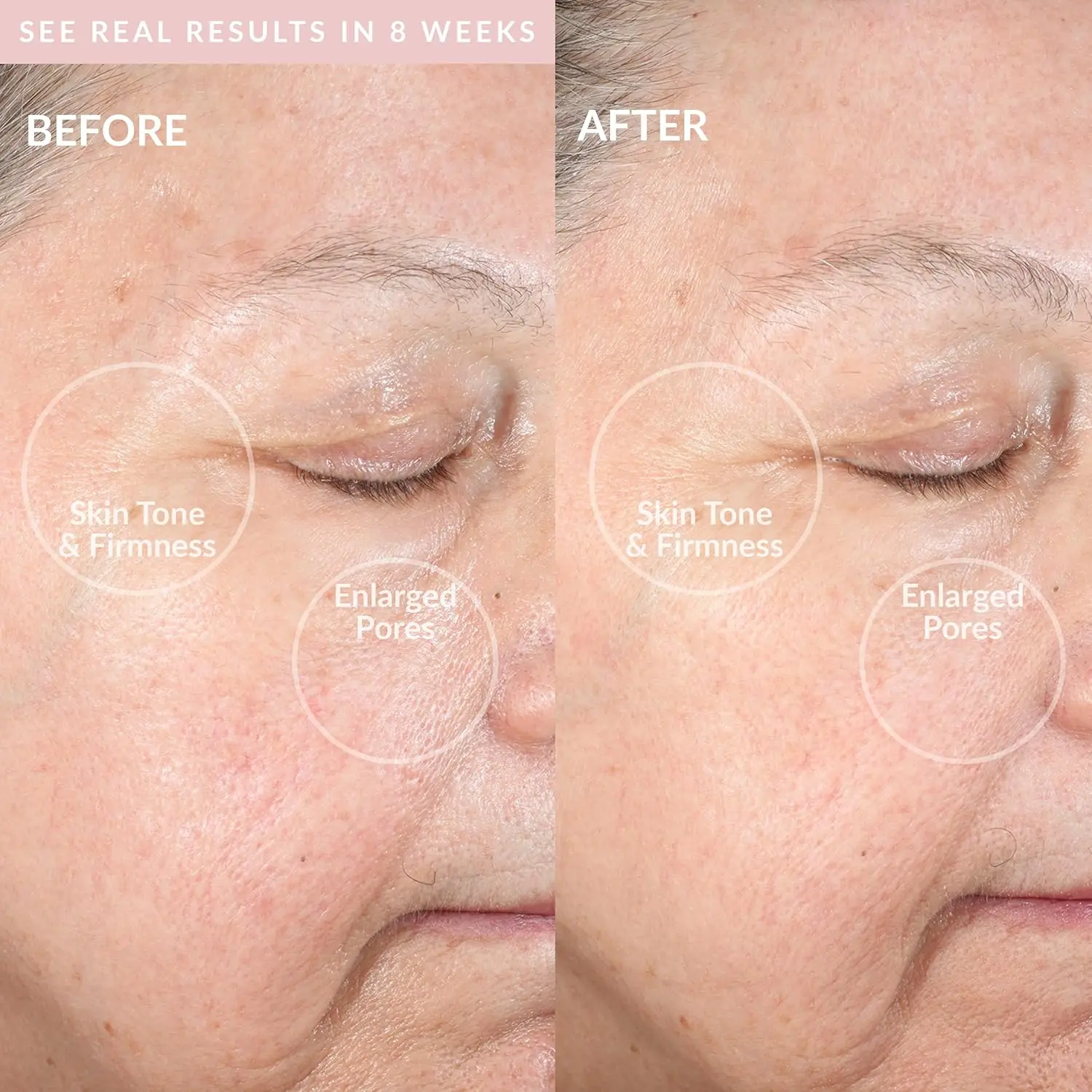 Smart Facial Cleansing Device for Deep Pore Cleaning, Gentle Exfoliation and Skin Rejuvenation