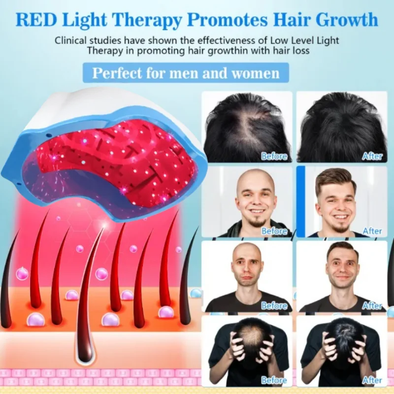 

Professional Grade Red Light Therapy - NIR LED Hair Growth Cap for Maximum Results