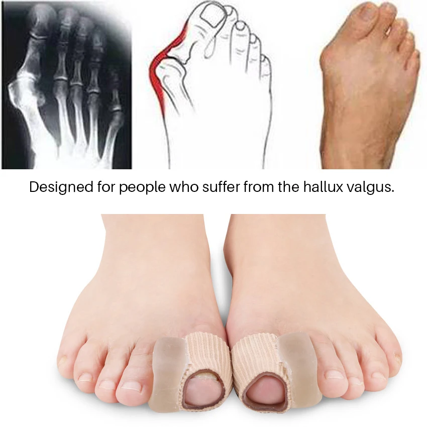 Separador de dedos para pedicura, Protector de silicona para el cuidado de los pies, alisador ortopédico, Corrector de juanetes, Hallux Valgus