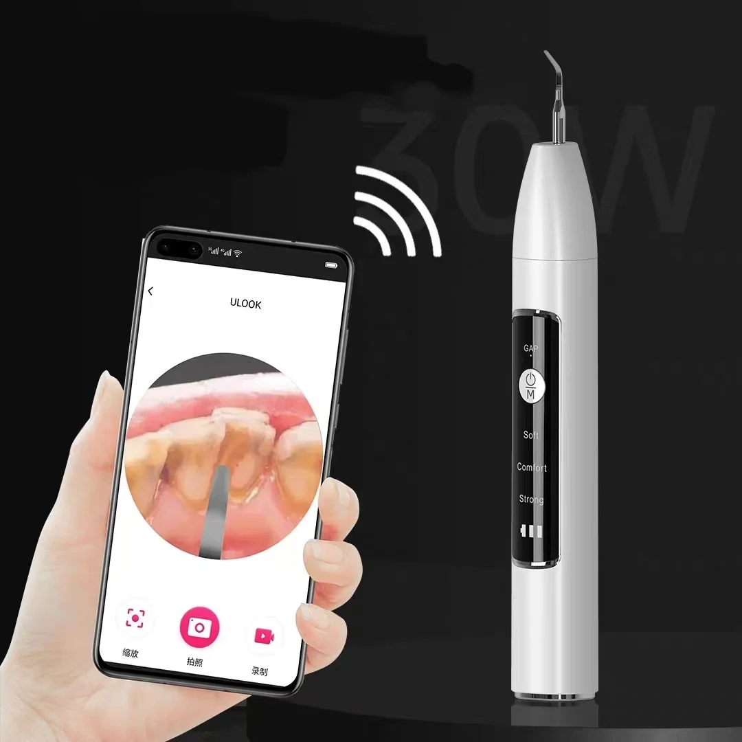 Premium App Visuele Bedrade Calculus Remover Tandvlekflosser Ultrasone Tandheelkundige Scaler