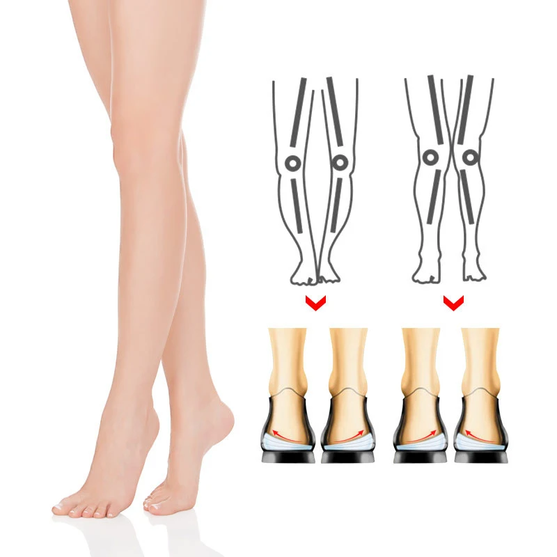 4 Layers Orthopedic Insoles for Feet O/X Leg Type Valgus Varus Correction Plantar Fasciitis Gel Insole Magnet Massage Foot Care