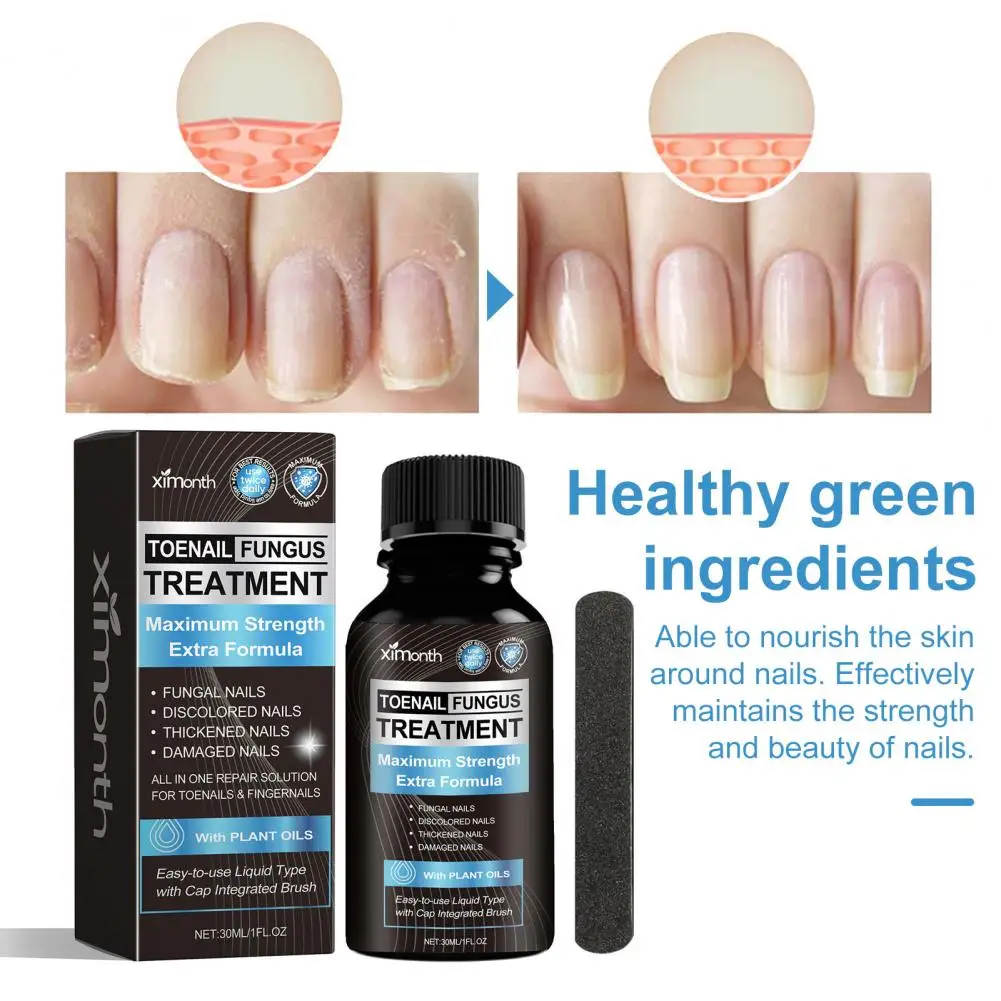 Home Remedy for Toenail Fungus Natural Extra Strength Nail Fungus Treatment Solution for Healthy Toenail Fingernails Repair