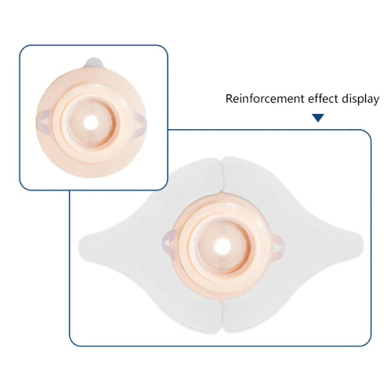 Ostomy Barrier Strips Y Shape Hydrocolloid Adhesive Seal Extender Strip For Colostomy Bags Ileostomy Tape For Stoma Ostomy Bag