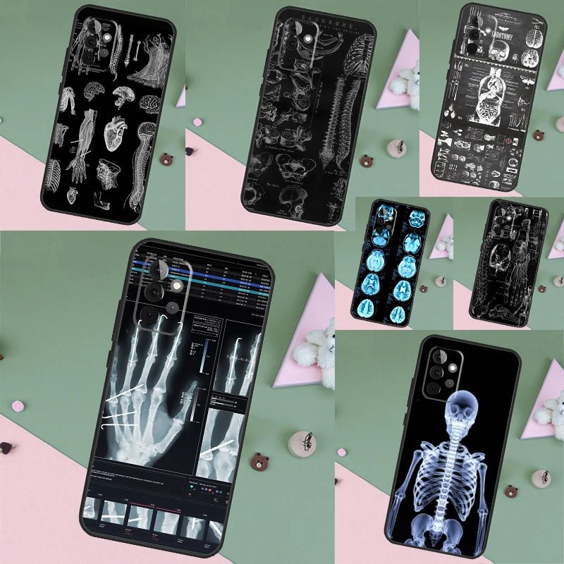 Radiological Human Organs Skeleton Funda Phone Case For Samsung Galaxy A14 A13 A12 A54 A53 A52 A34 A33 A32 A24 A23 A22 A51 A71