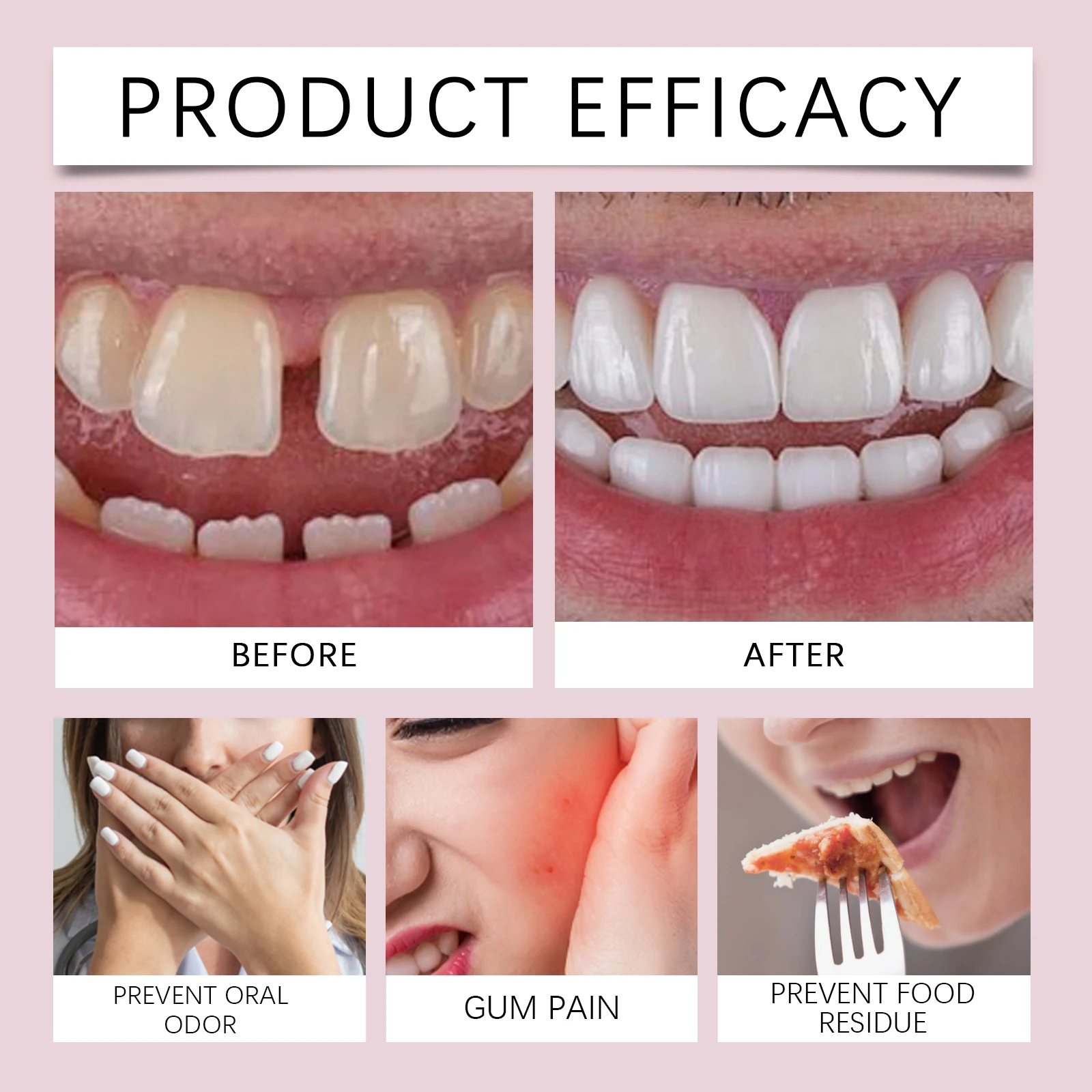 لاصق أسنان من البلاستيك الحراري، لاصق تثبيت طقم أسنان يدوم طويلاً، تحسين الراحة، منتجات العناية بأطقم الأسنان Odontologia #5