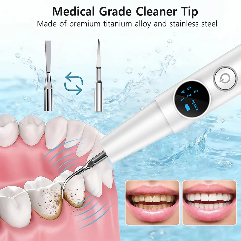 Thumbnail 3 - #30 Ultrasonic Scalers List of Top Picks