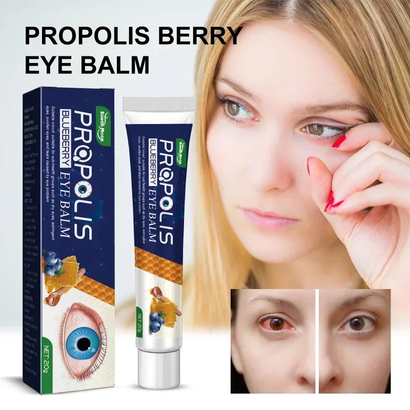 Propolis blueberry eye care cream relieve eye fatigue Dry stay up late Protect vision prevent myopia Moisturizing eye ointment