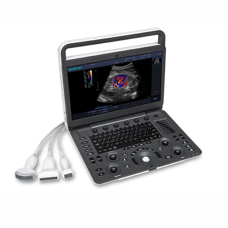 Products subject to negotiationUltrasound Scanner Cardiac Vascular Color Doppler Sonoscape E2 E3