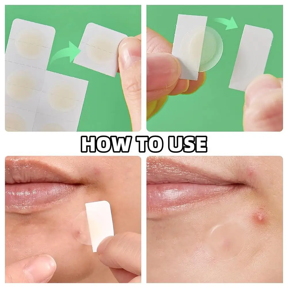 Parche para acné con microagujas, eliminación de acné, corrector suave resistente al agua, parche Invisible transpirable, parches para cubrir el acné, herramienta de maquillaje suave