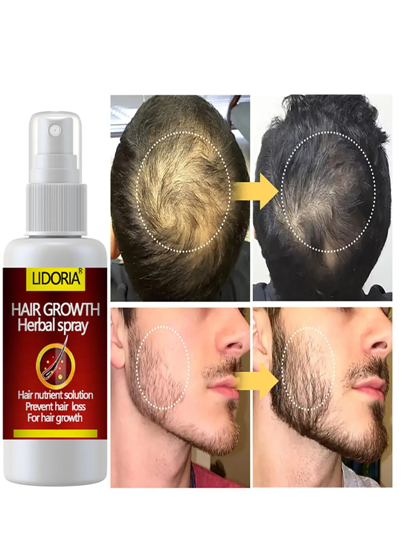 Original Hair Loss Essential Oils Natural Grow Hair Faster Regrowth Ginger Fast Hair Growth Repair Damaged Hair Care