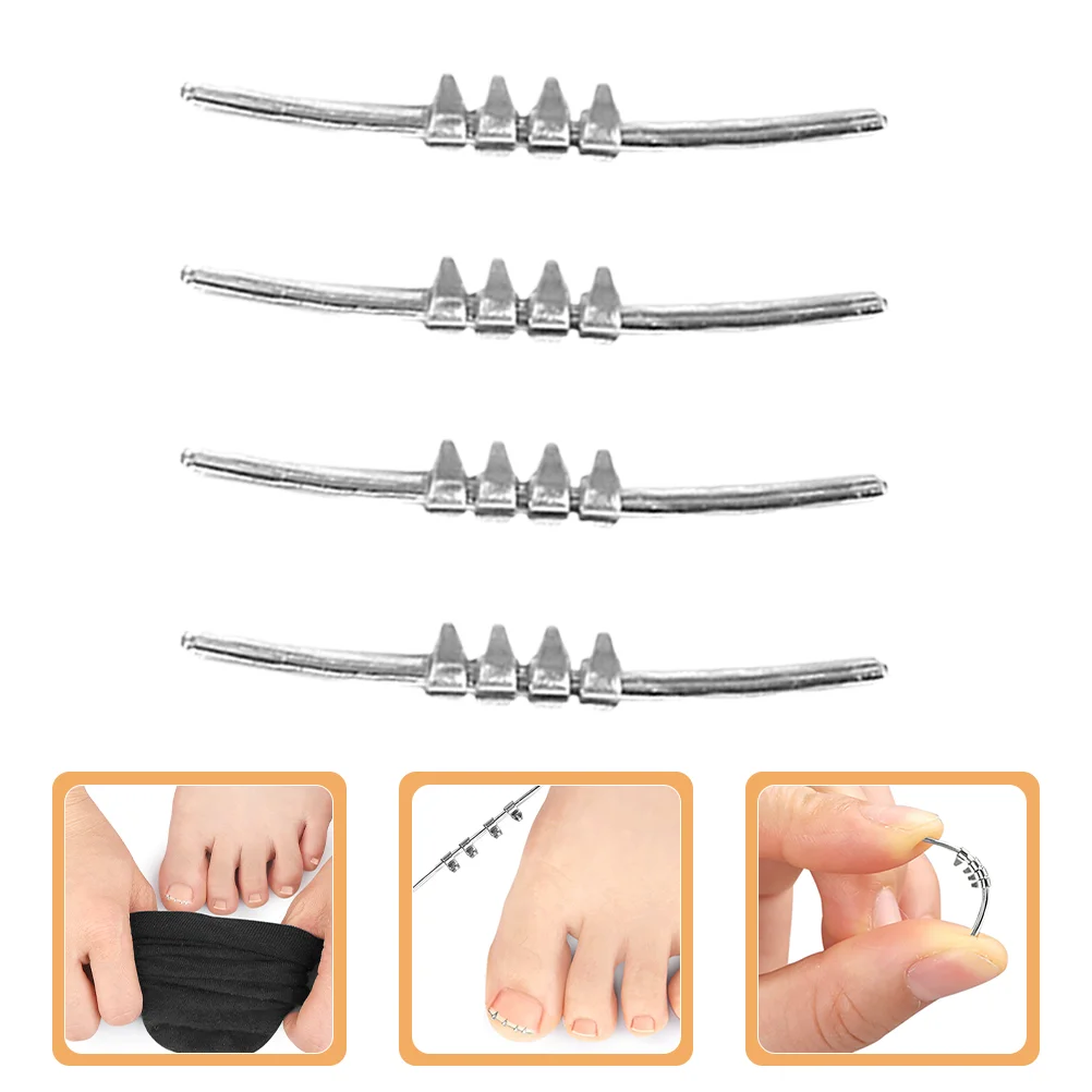 4 Pcs Toe Fixation Tape Tools Nail Straightening Clip Toenail Buckle Repair Carbon Steel Ingrown Men and Women