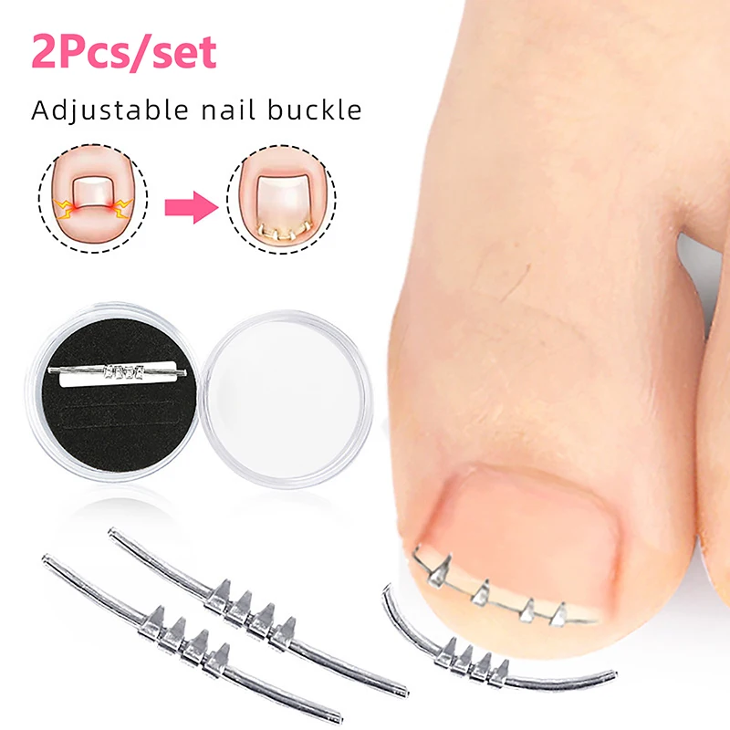 Herramienta profesional de corrección para el cuidado de los pies, herramientas correctoras de uñas encarnadas, recuperación de pedicura, ayuda para el cuidado de las uñas del dedo del pie, 2 uds.