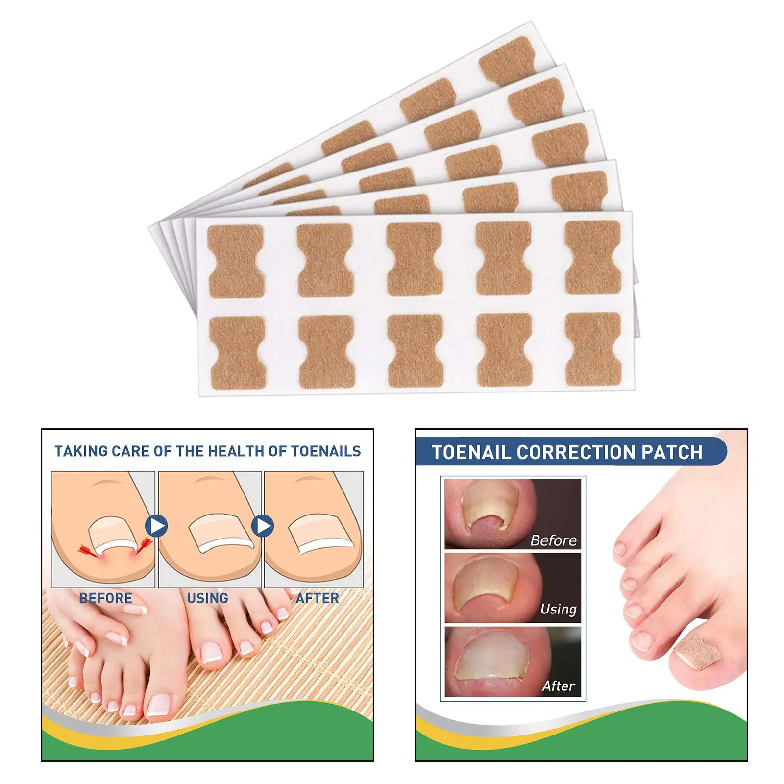 50Pcs เท้า Stick Patch เท้า Care Self Adhesive Toe เล็บ Corrector สติกเกอร์สำหรับ Salon บ้านผู้หญิง