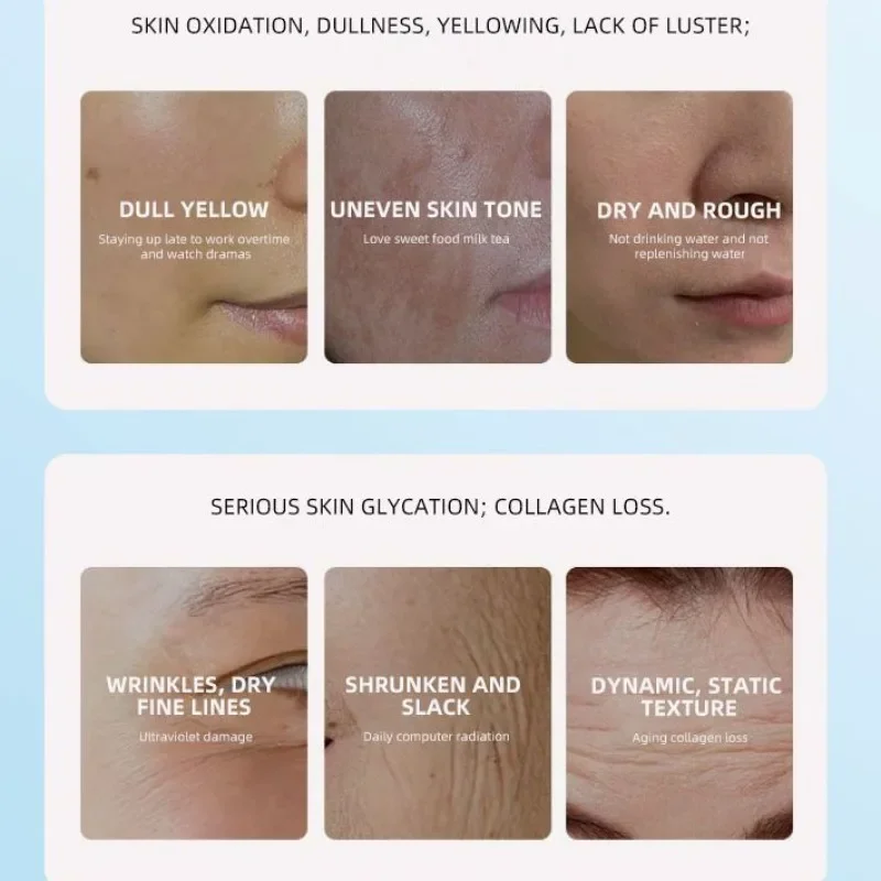 377 Niacinamide Crema viso schiarente Idratazione Glow Booster Pelle opaca, Crema idratante non grassa Cura delle macchie scure Rilassamento del viso