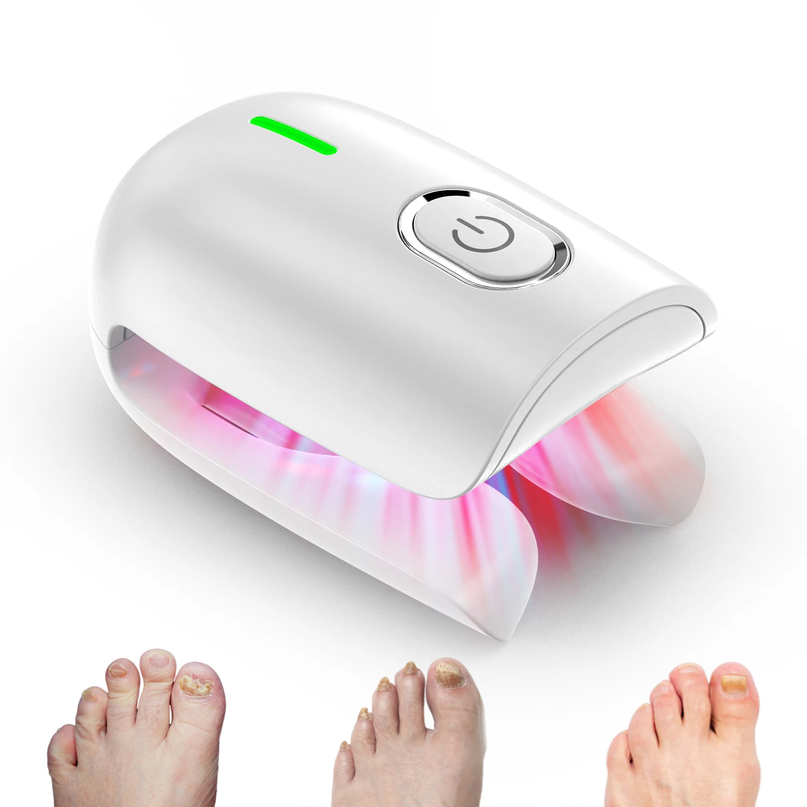 Dispositivo láser para hongos en las uñas KTS, dispositivos de limpieza para uñas de los pies, dispositivo láser para hongos, cuidado de la onicomicosis, 470nm, 660nm, 905nm, infrarrojos