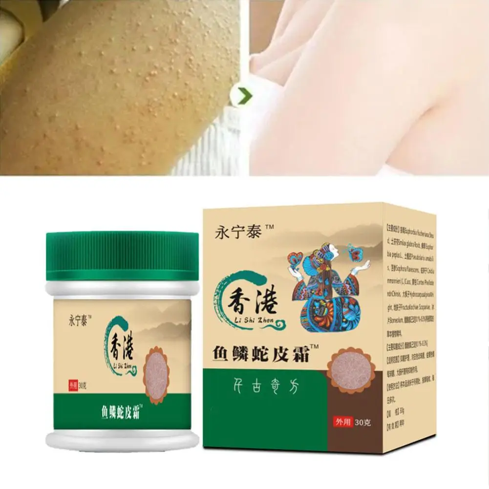 ครีมกำจัดหนังไก่สำหรับผิวงูเกล็ดปลา Keratosis Pilaris จุดด่างดำดูแลซ่อมแซมรูขุมขนอย่างนุ่มนวล S0T2