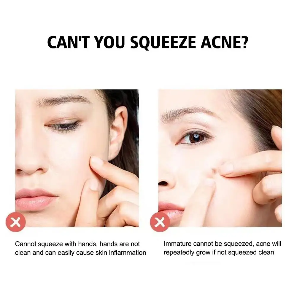 Alemão Ultrafino No. 5 células espinhas cravo clipe pinças salão de beleza especial raspagem & fechamento artefato acne agulha ferramentas