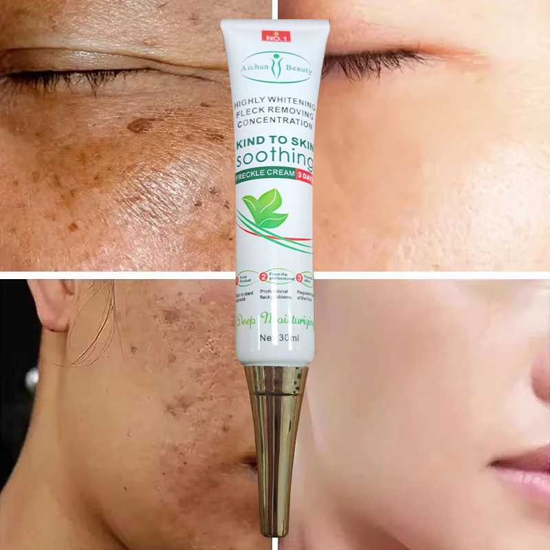 Powerful Dark Spots Remover Freckle Whitening Cream Melanin Correcting Anti Pigmentation Brighten Korean Day Night Facial Care