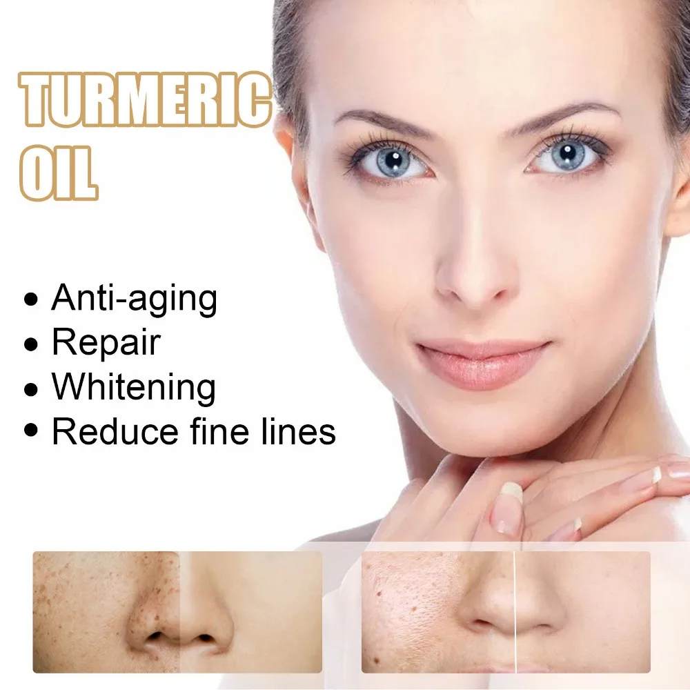 30ml Turmeric Oil Skin To Lightening Acne Dark Patches Acne Bright Skin Dark Corrector Anti Aging Face Whitening Serum Care