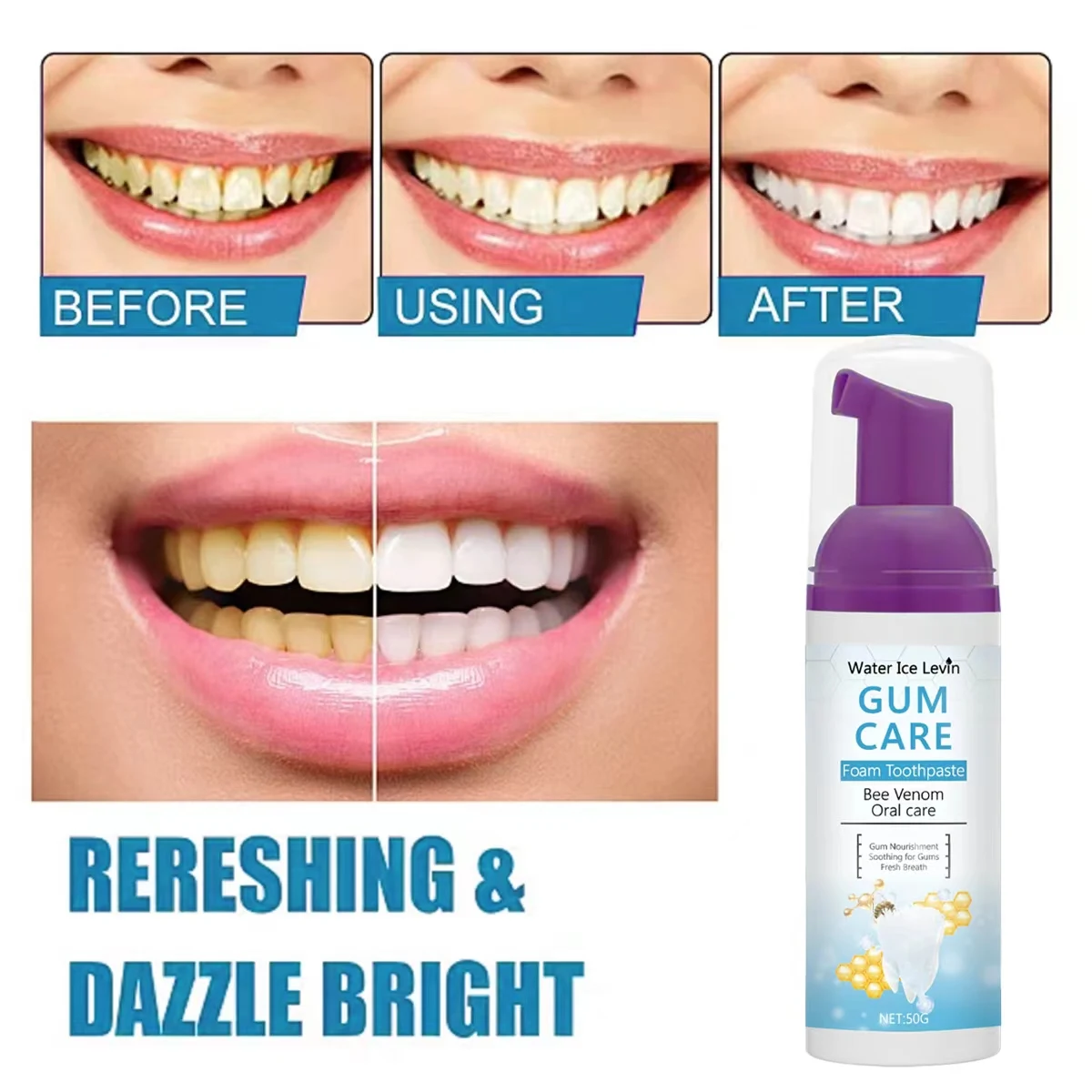 Water Ice Levin Gum Care Foam Toothpaste with Bee Venom & Xylitol - Teeth Whitening Mousse for Soothing Gums & Fresh Breath