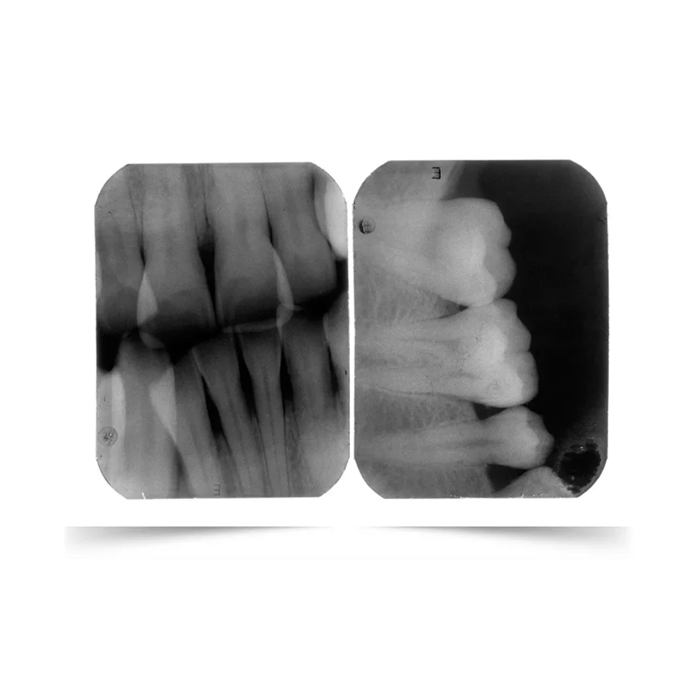 50 Pz/scatola Originale Italia Ad Alta Definizione Sviluppo Rapido Dentale Auto Sviluppo X Ray Pellicola Con Monobatta Per Odontoiatria