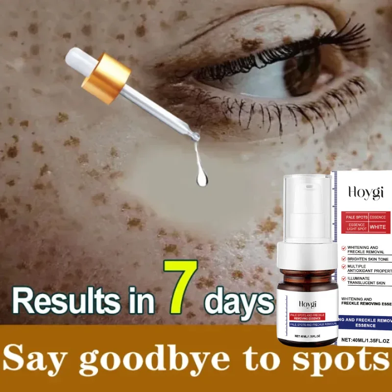 Powerful Spot-removing Whiten Serum Cream Vitamin C Skin Brighten Essence Removal Melasma Dark Spots Moisturize Beauty Skin Care