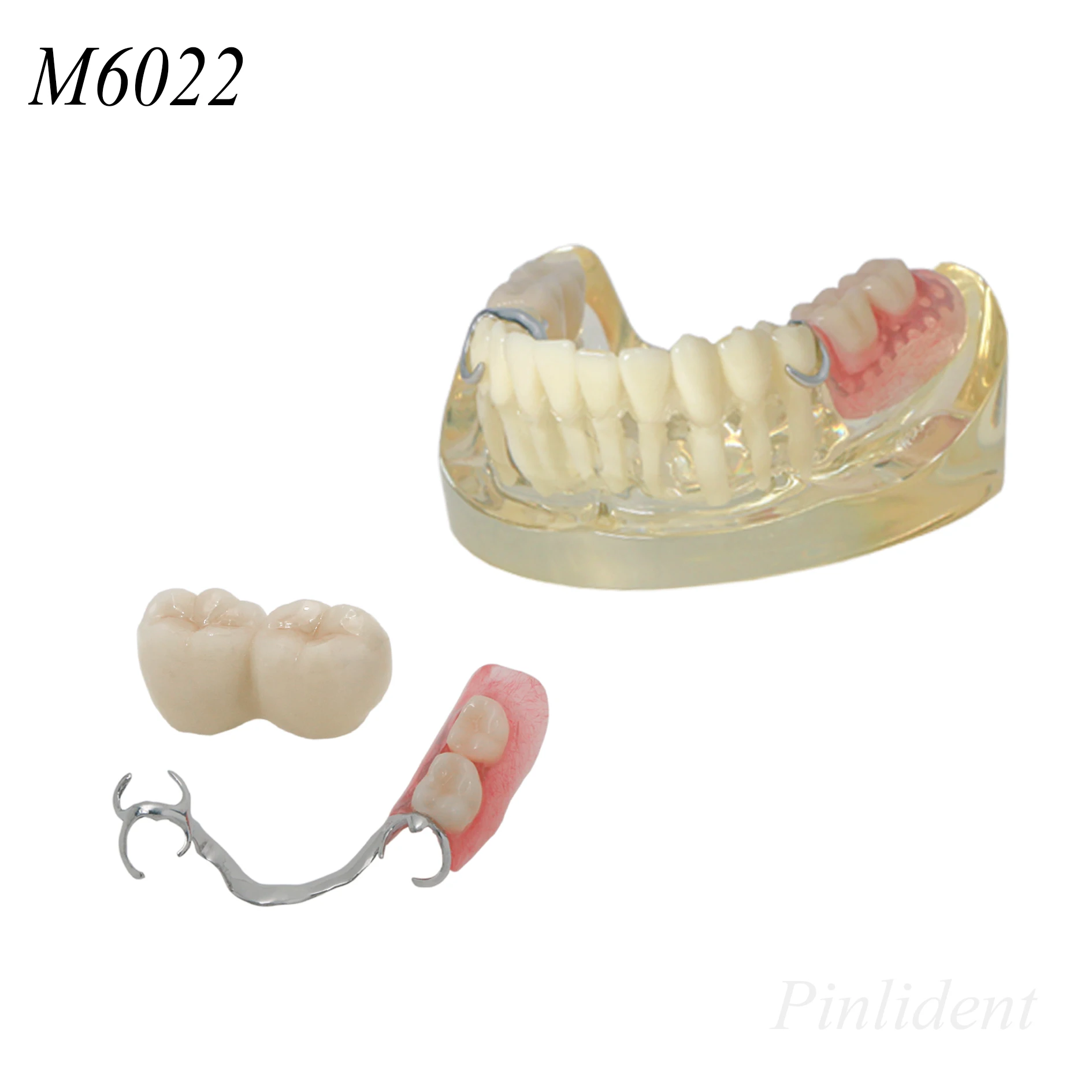 Dental Teeth Models M6022 2 Implants Teaching Research Demonstrations Removable