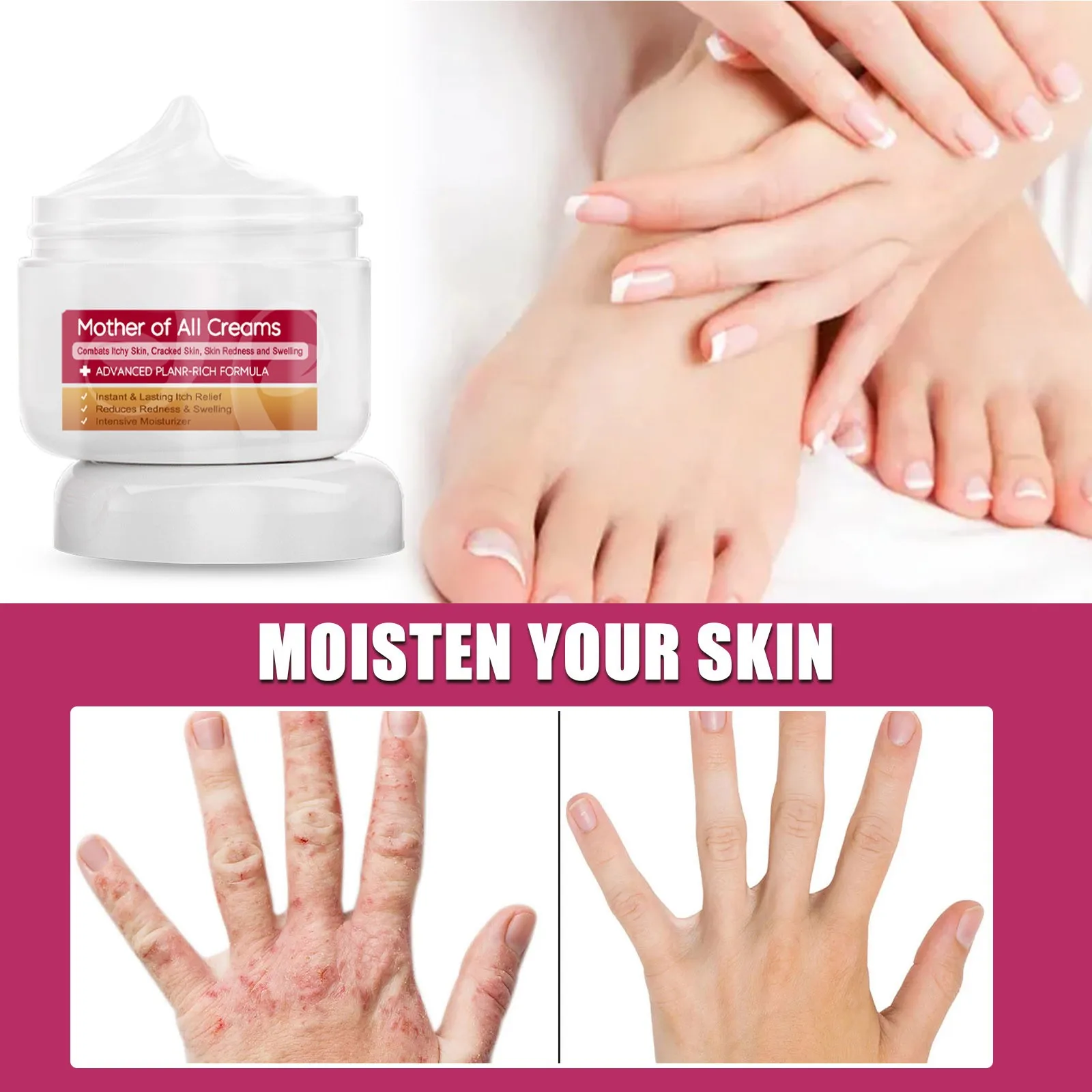 Skin Moss Repair-Cream Moisturizing And Repairing Hands And Feet Relieving Itching Moisturizing And Moisturizing The Skin 50g