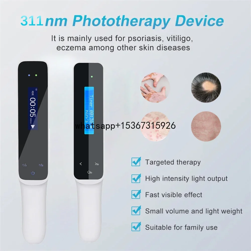 311NM Ultraviolet Phototherapy Instrument Vitiligo Treatment Lamp UV Lamp Laser for Therapy Vitiligo Psoriasis Skin Disease