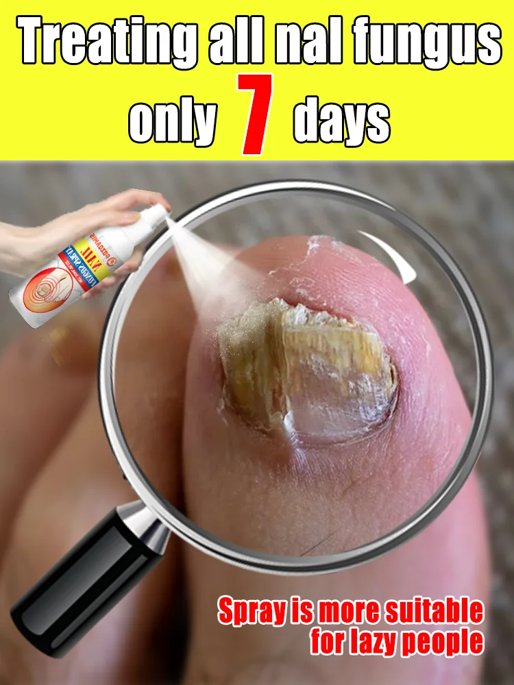 

The most powerful black technology in 2025,ᵉᶠᶠᵉᶜᵗⁱᵛᵉ ⁿᵃⁱˡ ᶠᵘⁿᵍᵘˢ ᵗʳᵉᵃᵗᵐᵉⁿᵗ⸴ ʳᵉˢᵗᵒʳᵉ ⁿᵃⁱˡ