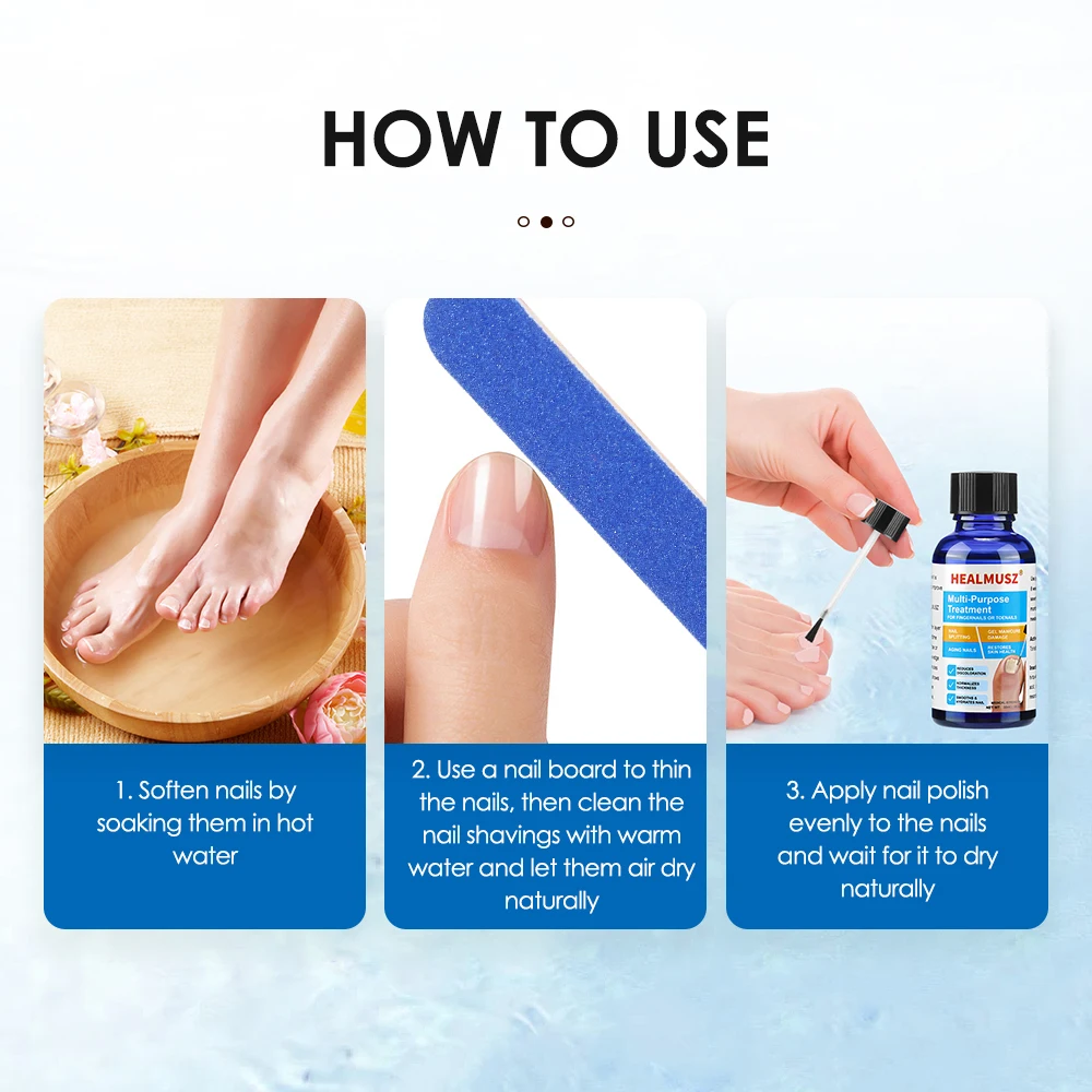 30ml เท้าเล็บเชื้อรา Treatment Toenail Repair Essence Serum Liquid ฟุต Toes Care เครื่องมือเชื้อรา Removal